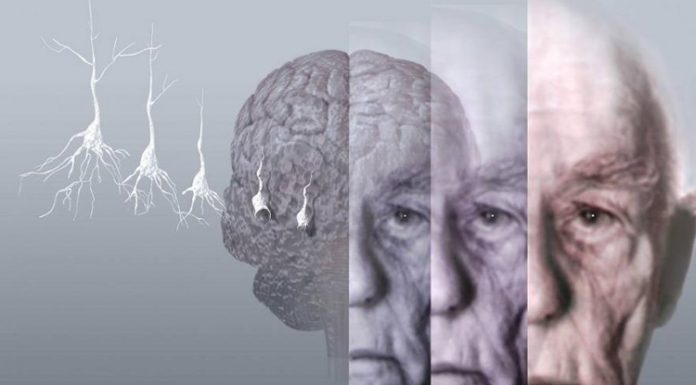 Prof. Dr. Atıf AKDAŞ ‘Alzheimer Hastalığında Risk Faktörleri’