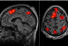 ‘Beyin, ölüm ve sonrasında bile aktif ve koordineli kalabiliyor!’