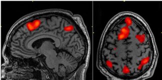‘Beyin, ölüm ve sonrasında bile aktif ve koordineli kalabiliyor!’