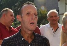 O’na bir yüz verildi; işe yaramadı, yüz’süz çıktı!