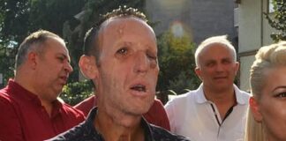 O’na bir yüz verildi; işe yaramadı, yüz’süz çıktı!