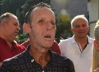 O’na bir yüz verildi; işe yaramadı, yüz’süz çıktı!