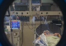 Covid-19’a 18 aydır direnen hasta hayatını kaybetti!