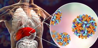 O ‘Şehir Dedikodusu’ boşa çıktı…DSÖ: “Hepatit vakaları Kovid-19 aşılarından kaynaklanmıyor”