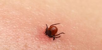 KKKA kâbusu: vaka sayısı 17, ölü sayısı 2 oldu