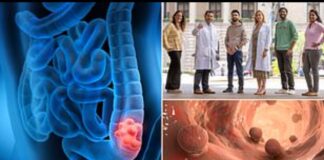 Kanser tedavisinde devrim: Klinik araştırma aşamasındaki bir ilaç, denenen her hastada kanseri yok etti!