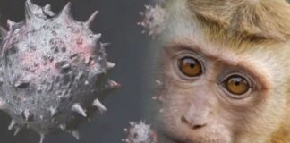 Maymun çiçeği virüsü 92 ülkede görüldü: Dünya genelindeki vaka sayısı 35 bini aştı