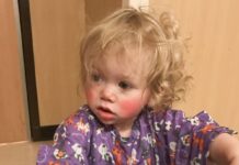 Dünyada sadece 100 kişide olduğu biliniyor: Ivy’ın suya alerjisi var; buna, kendi gözyaşı da dahil!