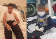 Bitlis’te köpek ısırması sonucu kuduz olan çocuğun doktoru: “Büyük beklenti içinde değiliz ağır koma döneminde”