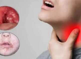 Bakan Koca, “Türkiye’de Strep A vakası görüldü, İlaç tedavisiyle 24 saat sonra bulaşıcılık artık söz konusu değil”