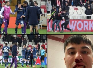 ⚽Utanç verici olay; Sivasspor taraftarı, Fiorentina’nın futbolcusu Alessandro Bianco’ya saldırıp burnunu kırdı