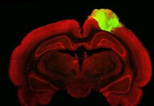 Fareler birbirlerine şöyle takılıyordur: ‘İnsan Beyinli’… İnsan Beyin Hücreleri Farelere Nakledildi