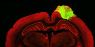 Fareler birbirlerine şöyle takılıyordur: ‘İnsan Beyinli’… İnsan Beyin Hücreleri Farelere Nakledildi