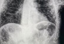 Tenya’ların bu kadar saldırgan olduğunu kim tahmin ederdi! Organları deldi geçti, beyne yumurtalarını bıraktı!