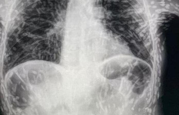 medium_2023-05-06-bcd936e167