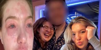 Manşet Olmamış Haberler: Cinsel ilişkiye girdiğinde kaşınmaya başlıyor…