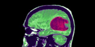 Harvard: “Yapay zeka beyin tümörü tedavisine yardımcı olabilir; Kanseri̇ çözmek için de ona İhtiyacımız var”