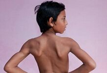 📽️’Kuyruk’ ile doğan 6 yaşındaki erkek çocuğa maymun tanrısı olarak tapılıyor