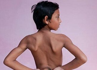 📽️’Kuyruk’ ile doğan 6 yaşındaki erkek çocuğa maymun tanrısı olarak tapılıyor