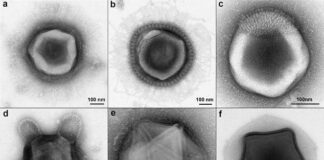 ABD New England topraklarında daha önce hiç görülmemiş dokunaçlar ve yıldız benzeri şekiller içeren nadir uzaylı benzeri virüsler keşfedildi