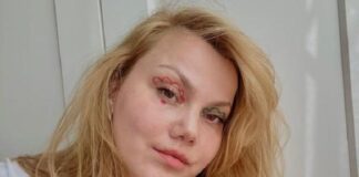 YouTuber ve yüksek mimar Merve Veziroğlu Yıldırım eşi tarafından bıçaklandı;Yoğun bakımda tedavi altına alındı