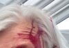 Rhiannon Fennell, 69, from Prestatyn was attacked by a seagull in her back garde