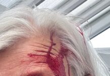 Rhiannon Fennell, 69, from Prestatyn was attacked by a seagull in her back garde
