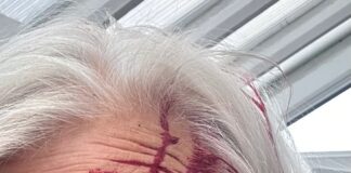 Galler’de bahçesinde martı saldırısına uğrayan kadın kan revan içinde kaldı!