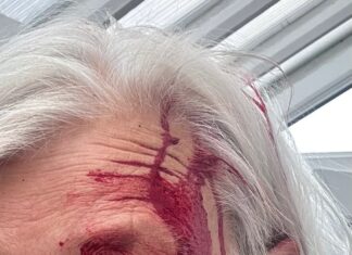 Rhiannon Fennell, 69, from Prestatyn was attacked by a seagull in her back garde