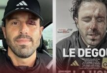 Avrupa’nın göbeğinde futbola kan bulaştı. Saldırıya uğrayan Lyon Teknik Direktörü Fabio Grosso’ya 13 dikiş atıldı!