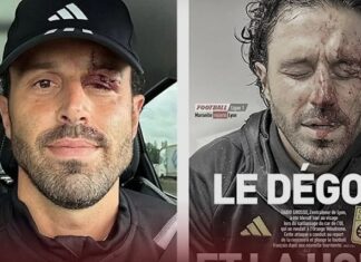 Avrupa’nın göbeğinde futbola kan bulaştı. Saldırıya uğrayan Lyon Teknik Direktörü Fabio Grosso’ya 13 dikiş atıldı!