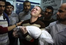 BM: “GAZZE’DE HER GÜN 400’DEN FAZLA ÇOCUK ÖLDÜRÜLÜYOR”