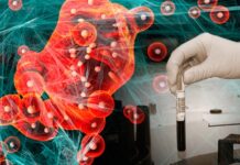 Yapay zeka bazı kanser türlerinin agresifliğini derecelendirmede biyopsiden iki kat daha doğru sonuç verdi.