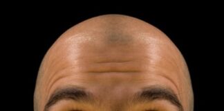 3D baskılı saç kökleriyle kelliğe çare umudu…