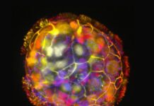 ABD’li araştırmacılar, insan hücrelerinden küçük canlı robotlar üretti.