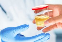 Sonunda çişin neden sarı olduğunu biliyoruz!