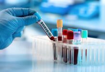 Yeni bir kan testi, 18 farklı kanseri erken evrelerinde tespit edebiliyor .