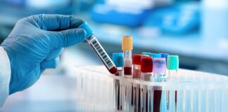 Yeni bir kan testi, 18 farklı kanseri erken evrelerinde tespit edebiliyor .