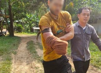 Tayland’da bir adam ayıdan kurtulmak için kolunu kesti