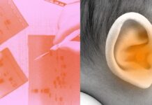 Kalıtsal sağırlığı olan çocuklar, gen terapisiyle işitme duyularını yeniden kazandı.