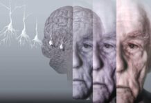 KAN TAHLİLİYLE DEMANS RİSKİ 15 YIL ÖNCEDEN TAHMİN EDİLEBİLECEK.