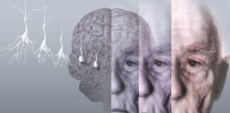 KAN TAHLİLİYLE DEMANS RİSKİ 15 YIL ÖNCEDEN TAHMİN EDİLEBİLECEK.