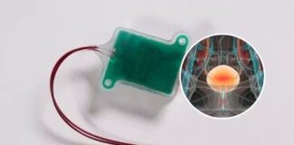 İşemeye ne kadar süreniz kaldığını bildirecek bir cihaz geliştirildi.