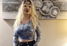 Estetik histerisi işe yaradı! O artık Dünyanın belki de en ‘iri’ dudaklarına sahip.