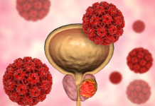 Tükürük testi ile erken prostat kanseri teşhisi!