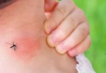 Ölümcül dang humması vakaları Avrupa’yı kasıp kavuruyor. Uzmanlar belirtiler ve önlemler konusunda neler söylüyor?