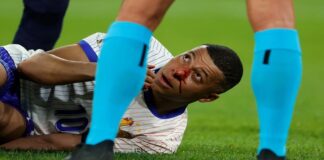 Mbappe’nin burnu kırıldı