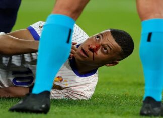 Mbappe’nin burnu kırıldı