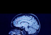 ‘Beyin atıklarımız’ nereye gidiyor? Atıklar, hangi hastalıklar ve nasıl bir uyku düzeniyle ilişkili?