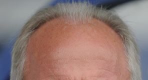 Dünyaca ünlü teknik direktör Sven-Goran Eriksson hayatını kaybetti.